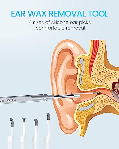 Teslong Teslong - Otoscopio digital con removedor de cera de oído, cámara de oído con herramientas de eliminación de cera de oído, otoscopio de video con luz para iPhone, iPad, teléfono Android, USB, púas de oído, impermeable, 1080p HD